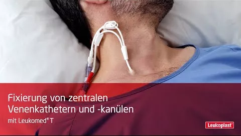 Video über LEUKOMED transp.sterile Pflaster 5x7,2 cm, 50 St