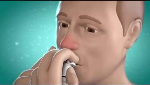 Video über NASIC für Kinder Nasenspray, 10 ml