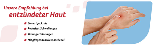 FeniHydrocort Creme 0,5 %, Hydrocortison 5 mg/g, wirksam bei Hautentzündungen, 30 g