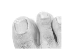 TERBINAFIN-1A Pharma Nagell.g.Nagelpilz 78,22mg/ml, 3.3 ml