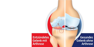GELENCIUM® arthro Tropfen, 100 ml