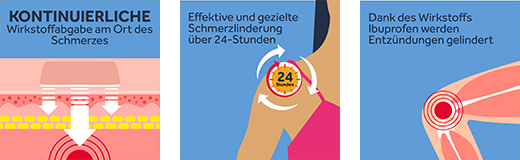 NUROFEN 24-Stunden Schmerzpflaster 200 mg, 4 St