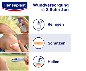 HANSAPLAST Elastic Fingerkuppen Pflasterstrips, 10 St