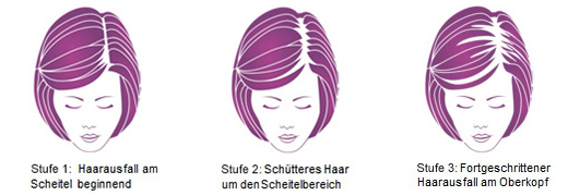 REGAINE Frauen Schaum 50 mg/g, 2X60 g