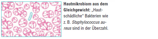AKTIVADERM ND Neurodermitis Hautkur akt.Probiotika, 250 g