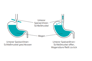 PANTOPRAZOL-1A Pharma 20mg bei Sodbrennen msr.Tab., 14 St