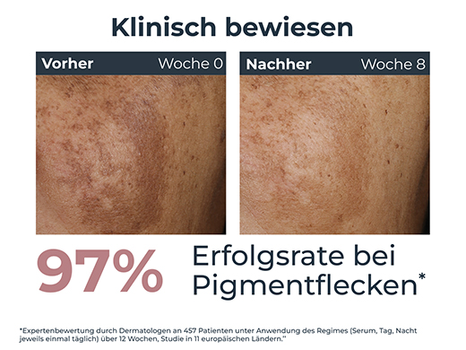 Eucerin Anti-Pigment Tagescreme LSF 30, 50 ml