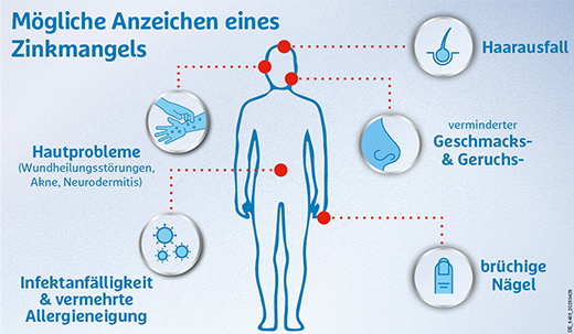 Zinkorot 25 mg hochdosierte Zink Tabletten, 20 St