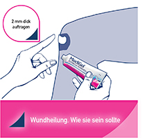 MEDIGEL schnelle Wundheilung, 20 g