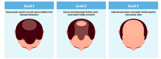Minoxicutan® Männer 50 mg/ml Spray, 60 ml