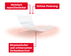 FIXOMULL Skin Sensitive 5 cmx5 m, 1 St