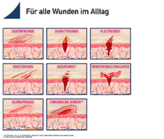 MEDIGEL schnelle Wundheilung, 20 g