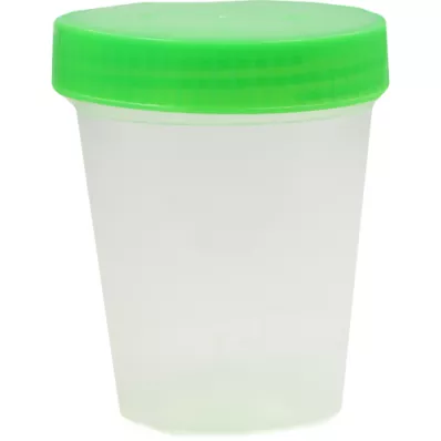 URINBECHER mit Schraubdeckel einzelverpackt, 1 St