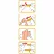 WELLION Safetylancets 28 G Sicherheitseinmallanz., 25 St