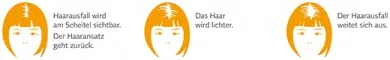 Instructions for use for Minoxidil BIO-H-TIN-Pharma 20 mg/ml Spray für Frauen, 3X60 ml - 4