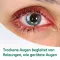 EVOTEARS Omega Augentropfen, 3 ml