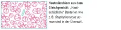 Instructions for use for AKTIVADERM ND Neurodermitis Hautkur akt.Probiotika, 250 g - 2