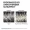 Vichy Dercos Anti-Schuppen Shampoo trockene Kopfhaut , 500 ml