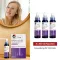 MINOXIDIL DoppelherzPharma 20 mg/ml Lösung für Frauen, 3X60 ml